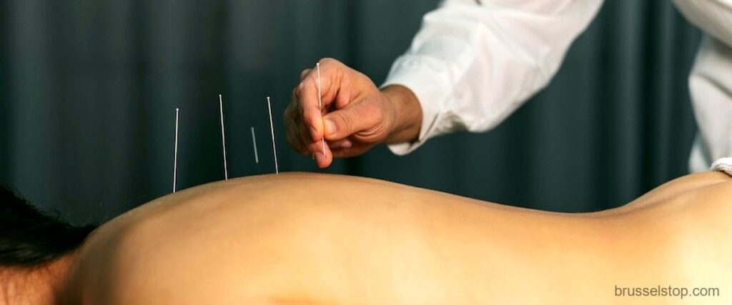 Les 7 meilleures cliniques d’acupuncture de Bruxelles